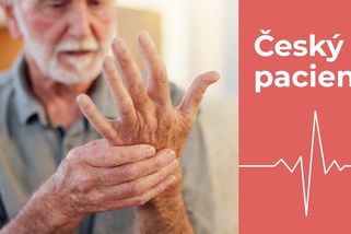 Náznaky parkinsona se objevují až 20 let před propuknutím. Varují i divoké sny - Seznam Zprávy